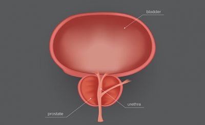 Prostate Enlargement In Men